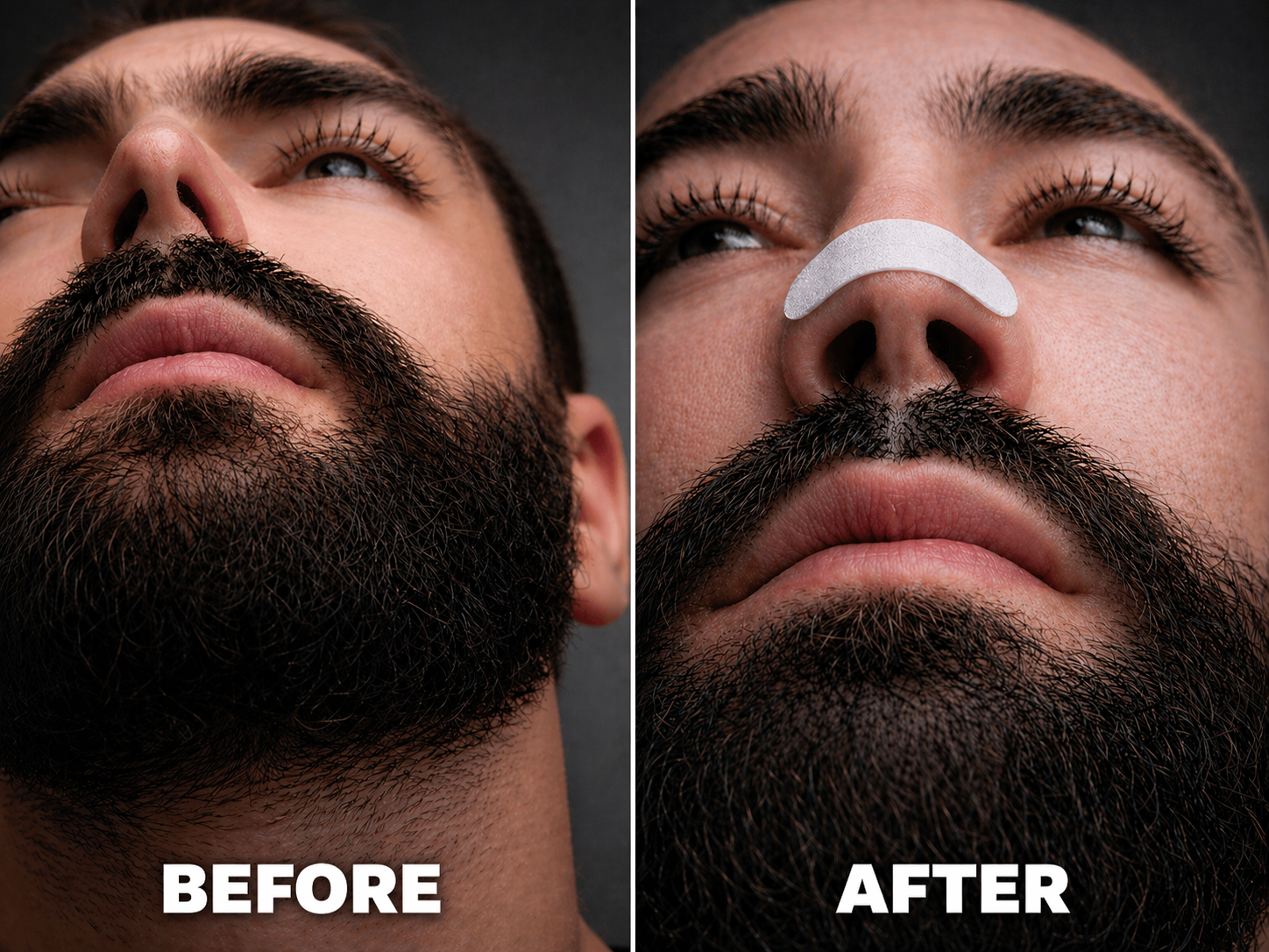 White Nasal Strips 30 Day Supply before and after