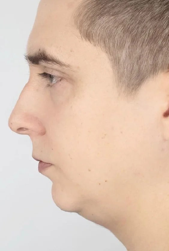 Facial development