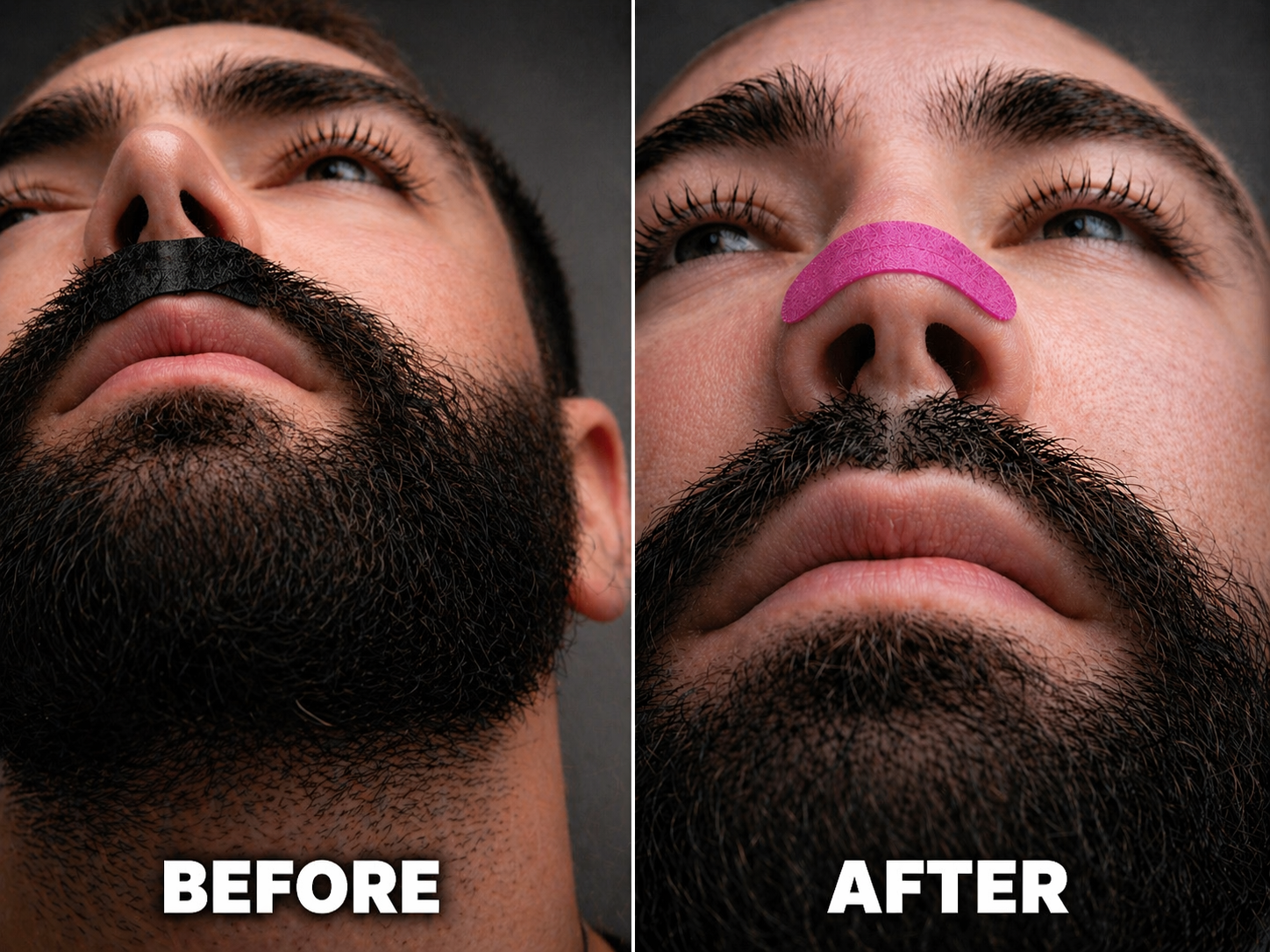 Pink Nasal Strips 30 Day Supply before and after